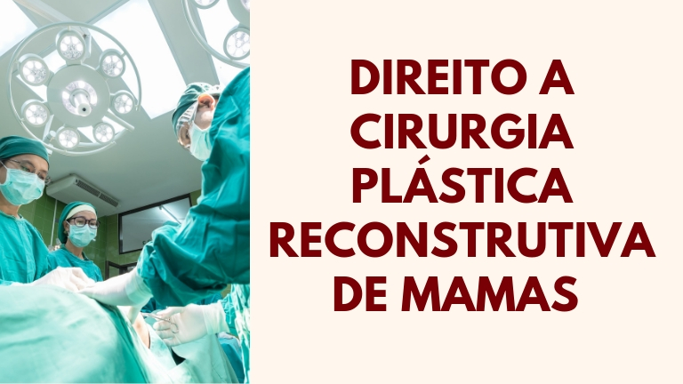 Direito a Cirurgia Plástica Reconstrutiva de Mamas pelo Sistema Único de Saúde (SUS)